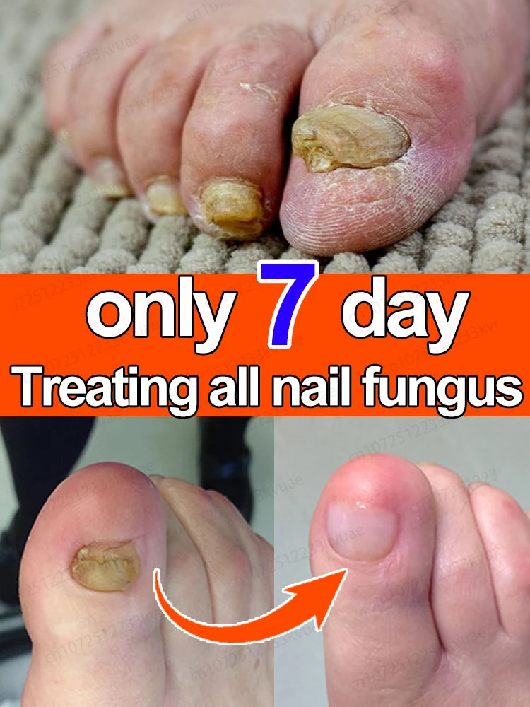 Nail Strengthener — Anti-Fragility & Anti-Yellowing Transparent Nail Treatment