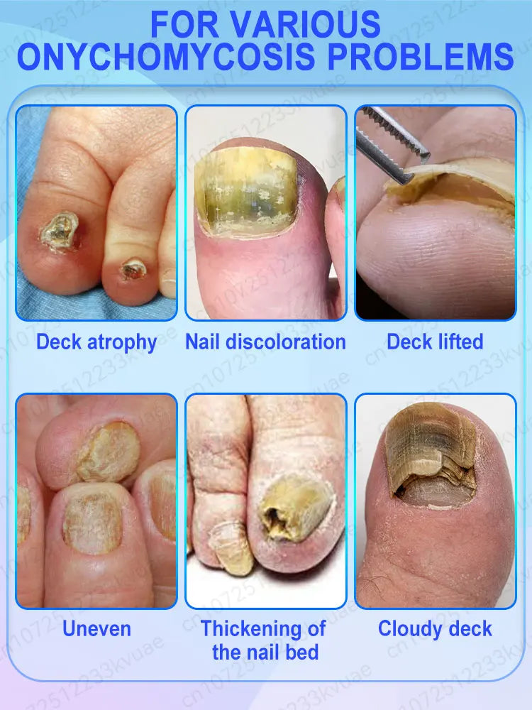 Nail Strengthener — Anti-Fragility & Anti-Yellowing Transparent Nail Treatment