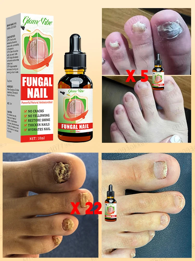 Nail Strengthener — Anti-Fragility & Anti-Yellowing Transparent Nail Treatment