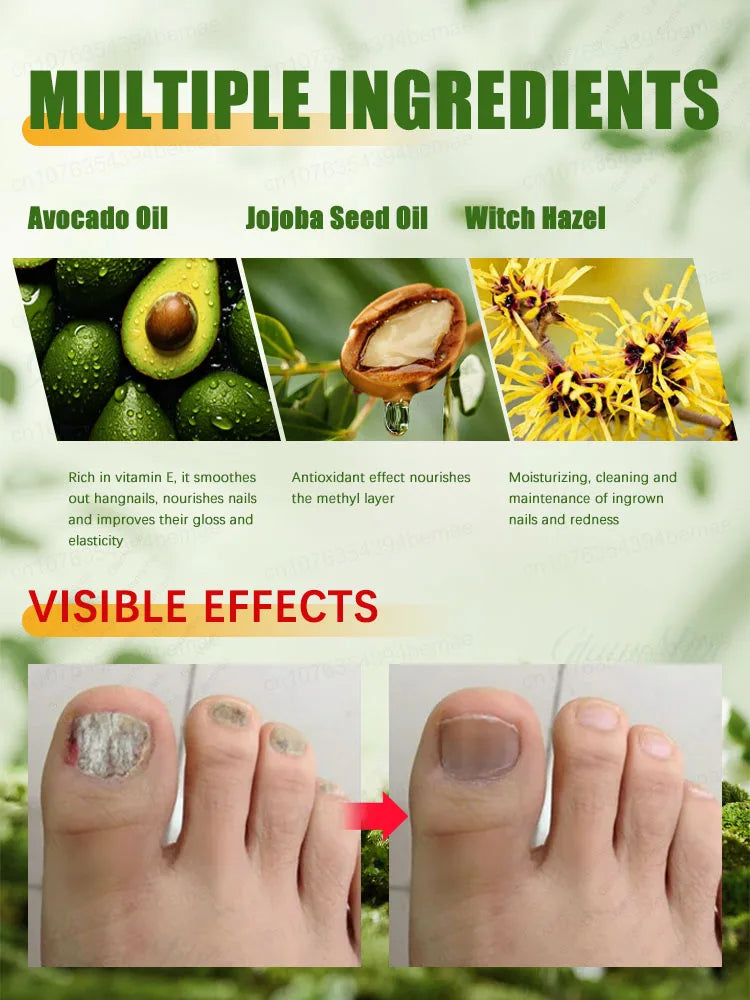 Nail Strengthener — Anti-Fragility & Anti-Yellowing Transparent Nail Treatment